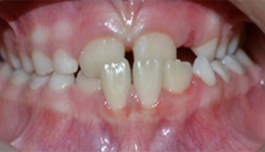 Orthodontic-treatment